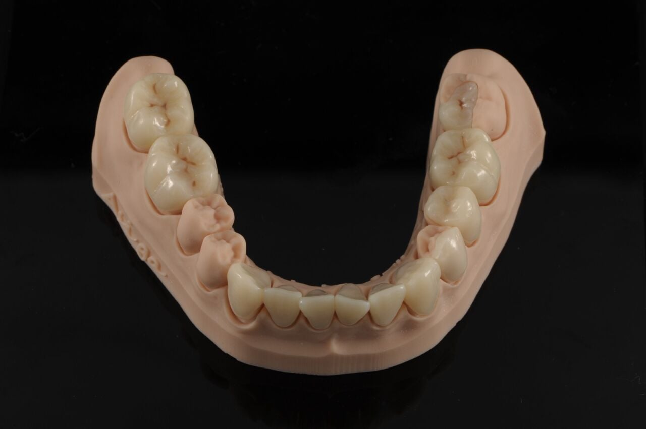 Daimi Dental 3D Baskı reçineleri: Kullanım Alanları, Teknik Özellikleri ve Doğru Materyal Seçimi