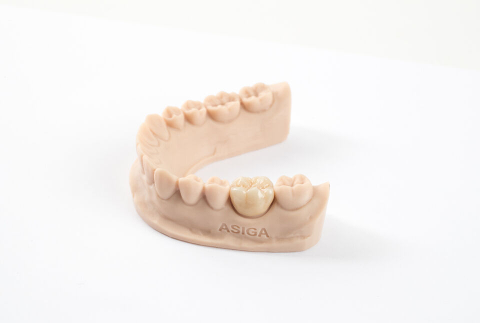 Asiga DentaTOOTH