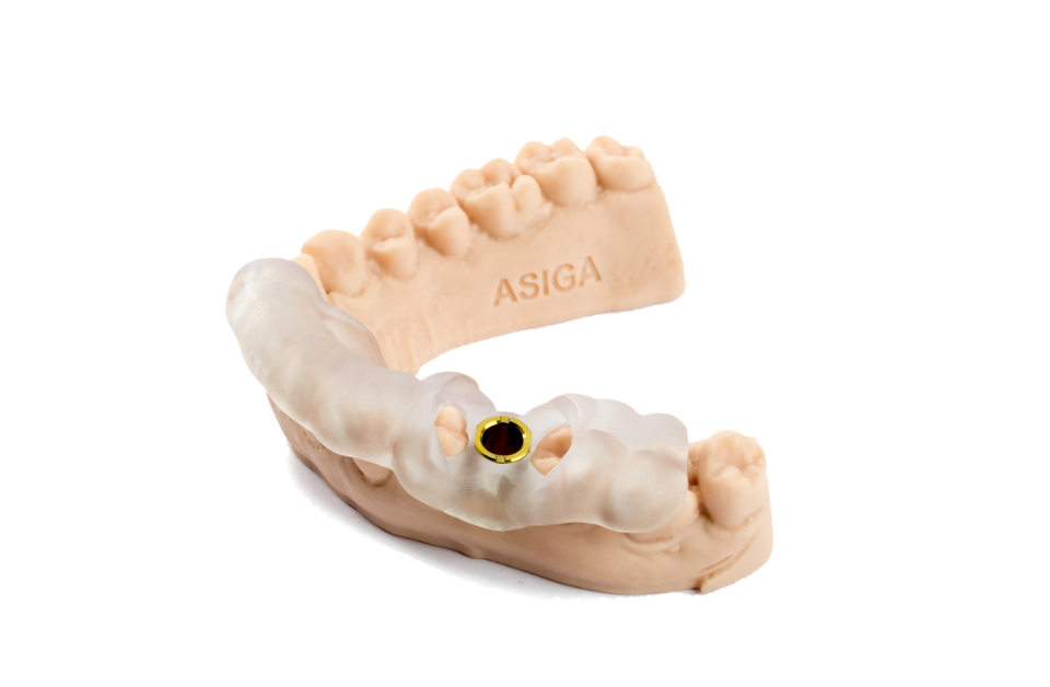 Asiga DentaGUIDE